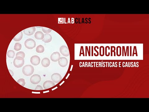 Anisocromia